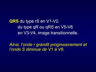 QRS du type rS en V1-V2.
du type qR ou qRS en V5-V6
en V3-V4, image transitionnelle.
Ainsi, l’onde r grandit progressivement et
l’onde S diminue de V1 à V6.

 