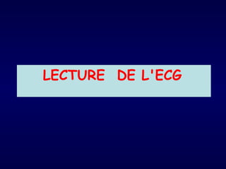 LECTURE DE L'ECG
 