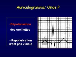 Auriculogramme: Onde P



-Dépolarisation
des oreillettes


- Repolarisation
n’est pas visible
 