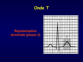 Onde T




   Repolarisation
terminale (phase 3)
 