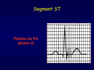 Segment ST




Plateau du PA
  (phase 2)
 