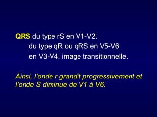 QRS du type rS en V1-V2.
   du type qR ou qRS en V5-V6
   en V3-V4, image transitionnelle.

Ainsi, l’onde r grandit progressivement et
l’onde S diminue de V1 à V6.
 