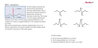 QRS complex
The QRS complex represents the
electrical forces generated by
ventricular depolarisation.Thus, it
represents the spread of electrical
depolarisation through the
ventricular muscle mass.The Q wave
is the first negative (downward)
deflection; the R wave is the first positive (upward) deflection in the
complex; the S wave is a negative deflection in the complex that follows
an R wave.
With normal intraventricular conduction, depolarisation occurs in an
efficient, rapid fashion.The duration (width) of the QRS complex should
not exceed 0.12 seconds or three small squares.
Q
R
S
R
S
R
Q S
The QRS complex:
•	 The first downward deflection is a Q wave
•	 The first upward deflection is an R wave
•	 A downward deflection after an R wave is an S wave
R wave
S waveQ wave
 