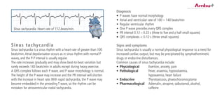 Sinus tachycardia
Sinus tachycardia is a sinus rhythm with a heart rate of greater than 100
beats/min.Atrial depolarisation occurs as in sinus rhythm with normal P
waves, and the P-P interval is usually regular.
The rate increases gradually and may show beat-to-beat variation but
rarely exceeds 140 beats/min in adults except during heavy exercise.
A QRS complex follows each P wave, and P wave morphology is normal.
The height of the P wave may increase and the PR interval will shorten
with the increase in heart rate.With rapid tachycardia, the P wave may
become embedded in the preceding T wave, so the rhythm can be
mistaken for atrioventricular nodal tachycardia.
Diagnosis
•	 P waves have normal morphology
•	 Atrial and ventricular rate of 100 – 140 beats/min
•	 Regular ventricular rhythm
•	 One P wave precedes every QRS complex
•	 PR interval 0.12 – 0.22 s (three to five and a half small squares)
•	 QRS complexes < 0.12 s (three small squares)
Signs and symptoms
Sinus tachycardia is usually a normal physiological response to a need for
increased cardiac output, but may be precipitated by symphathomimetic
drugs or endocrine disturbances.
Common causes of sinus tachycardia include:
•	 Physiological	 Exertion, anxiety, pain
•	 Pathological	 Fever, anaemia, hypovolaemia,
		 hypoxaemia, heart failure
•	 Endocrine	 Thyrotoxicosis, phaeochoromocytoma
•	 Pharmacological	 Adrenalin, atropine, salbutamol, alcohol,
		 caffeine
Sinus tachycardia. Heart rate of 112 beats/min.
 