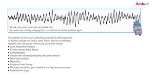 The symptoms of ventricular tachycardia can vary from mild palpitations
to dizziness, syncope and cardiac arrest.Always look for an underlying
treatable cause.The causes of ventricular tachycardia include:
•	 Acute myocardial infarction
•	 Chronic coronary artery disease
•	 Cardiomyopathy
•	 Valvular heart disease (particularly aortic valve disease)
•	 Mitral valve prolapse
•	 Myocarditis
•	 Congenital heart disease
•	 Electrolyte disturbance (particularly low and high serum potassium)
•	 Antiarrhythmic drugs
Torsades de pointes ventricular tachycardia with
the cardiac axis rotating, changing from one direction to another and back again.
 
