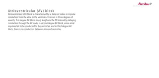 Atrioventricular (AV) block
Atrioventricular (AV) block is characterised by a delay or failure in impulse
conduction from the atria to the ventricles. It occurs in three degrees of
severity: first-degree AV block simply lengthens the PR interval by delaying
conduction through the AV node, in second-degree AV block, some atrial
impulses fail to be conducted to the ventricles, and in third-degree AV
block, there is no conduction between atria and ventricles.
 