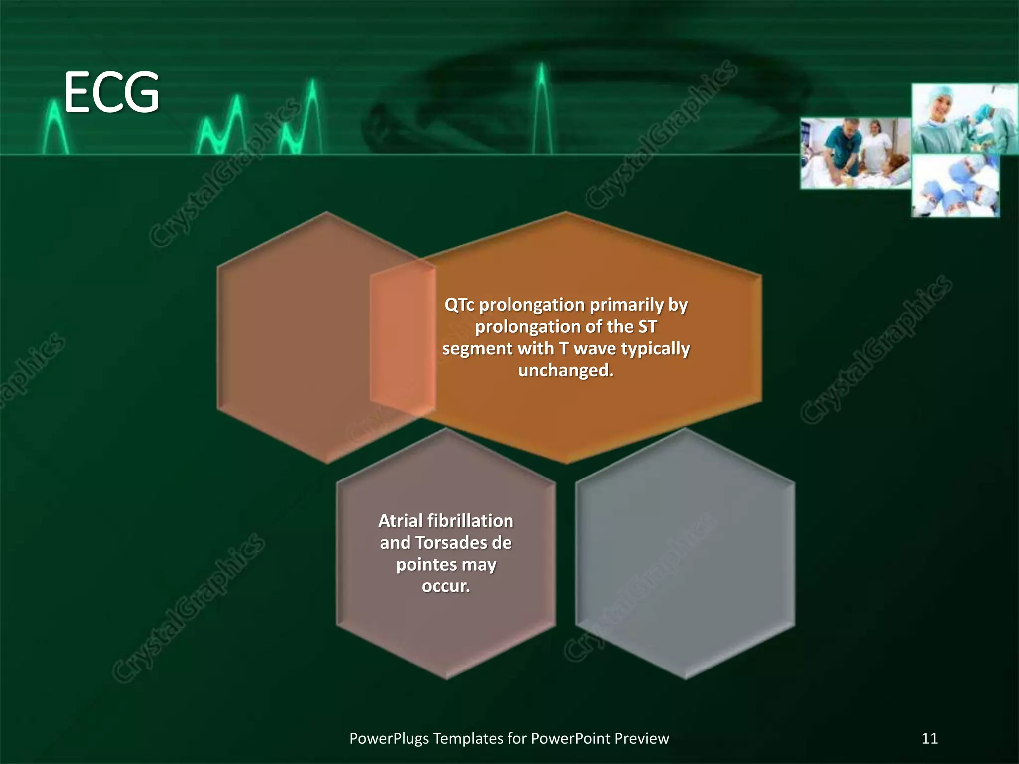 ECG
QTc prolongation primarily by
prolongation of the ST
segment with T wave typically
unchanged.
Atrial fibrillation
and Torsades de
pointes may
occur.
PowerPlugs Templates for PowerPoint Preview 11
 