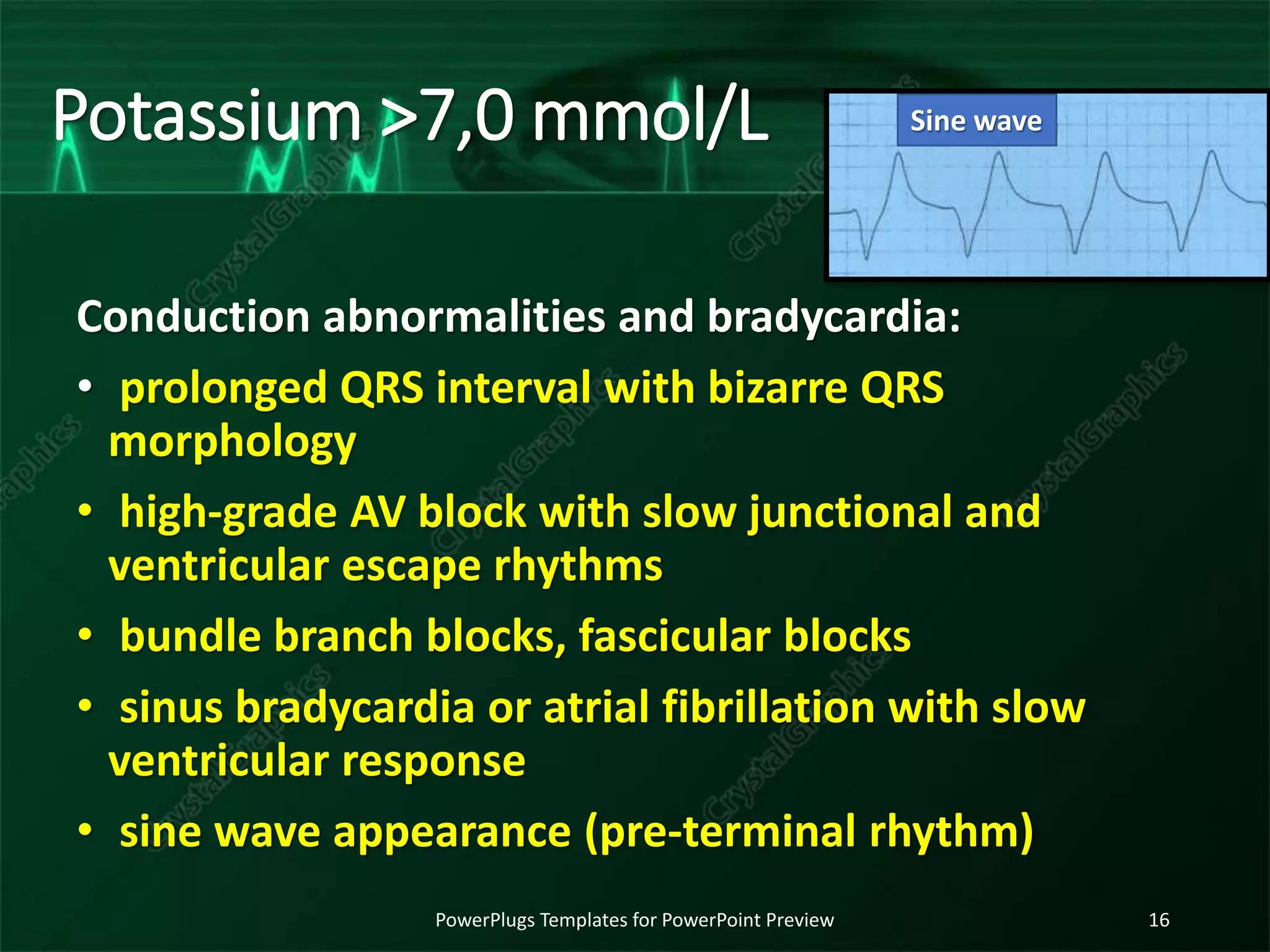 Potassium >7,0 mmol/L
Conduction abnormalities and bradycardia:
• prolonged QRS interval with bizarre QRS
morphology
• high-grade AV block with slow junctional and
ventricular escape rhythms
• bundle branch blocks, fascicular blocks
• sinus bradycardia or atrial fibrillation with slow
ventricular response
• sine wave appearance (pre-terminal rhythm)
PowerPlugs Templates for PowerPoint Preview 16
Sine wave
 