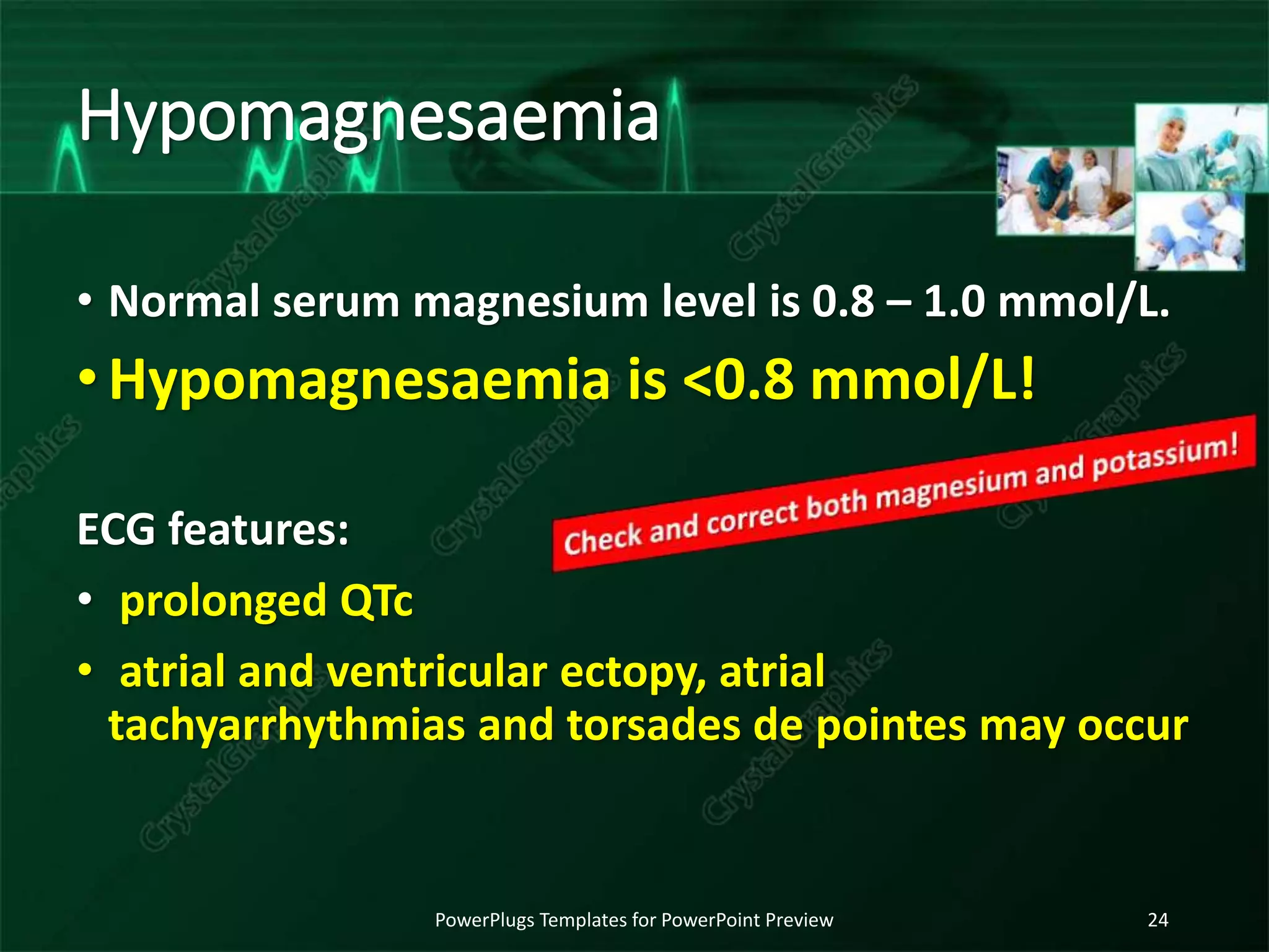 Hypomagnesaemia
• Normal serum magnesium level is 0.8 – 1.0 mmol/L.
•Hypomagnesaemia is <0.8 mmol/L!
ECG features:
• prolonged QTc
• atrial and ventricular ectopy, atrial
tachyarrhythmias and torsades de pointes may occur
PowerPlugs Templates for PowerPoint Preview 24
 