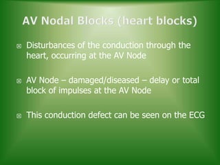 ECG & Heart block [doctors online] | PPTX