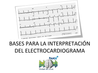 BASES PARA LA INTERPRETACIÓN
  DEL ELECTROCARDIOGRAMA
 