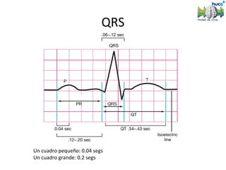 QRS




Un cuadro pequeño: 0.04 segs
Un cuadro grande: 0.2 segs
 