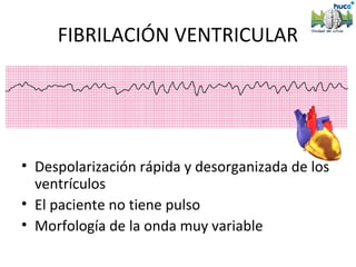 FIBRILACIÓN VENTRICULAR




• Despolarización rápida y desorganizada de los
  ventrículos
• El paciente no tiene pulso
• Morfología de la onda muy variable
 