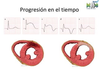 Progresión en el tiempo
 