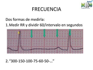 FRECUENCIA
Dos formas de medirla:
1.Medir RR y dividir 60/intervalo en segundos




2.“300-150-100-75-60-50-…”
 