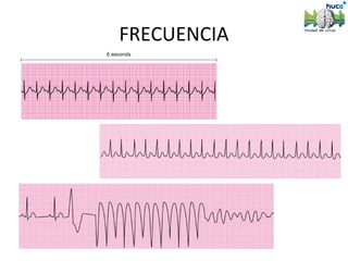 FRECUENCIA
 