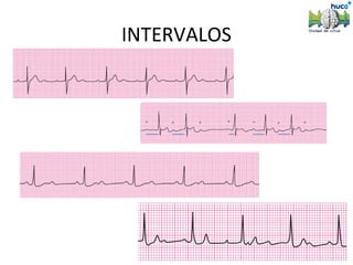 INTERVALOS
 