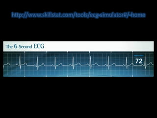 ECG HUCA