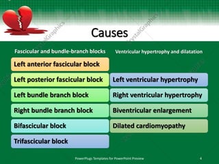 Causes
Fascicular and bundle-branch blocks
Left anterior fascicular block
Left posterior fascicular block
Left bundle branch block
Right bundle branch block
Bifascicular block
Trifascicular block
Ventricular hypertrophy and dilatation
Left ventricular hypertrophy
Right ventricular hypertrophy
Biventricular enlargement
Dilated cardiomyopathy
PowerPlugs Templates for PowerPoint Preview 4
 