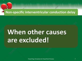 Non-specific interventricular conduction delay
When other causes
are excluded!
PowerPlugs Templates for PowerPoint Preview 7
 