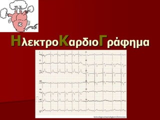 ΗλεκτροΚαρδιοΓράφημα
 