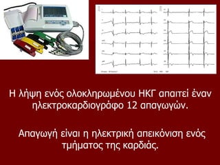 Η λήψη ενός ολοκληρωμένου ΗΚΓ απαιτεί έναν
ηλεκτροκαρδιογράφο 12 απαγωγών.
Απαγωγή είναι η ηλεκτρική απεικόνιση ενός
τμήματος της καρδιάς.
 