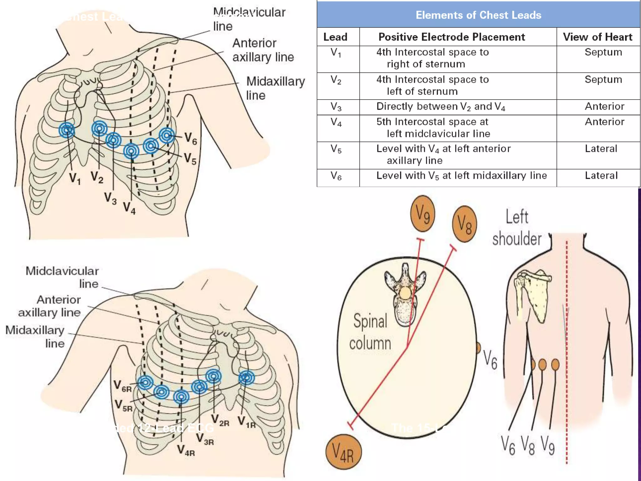 Standard Chest Lead Electrode Placement

The Right-Sided 12-Lead ECG

The 15-Lead ECG

 