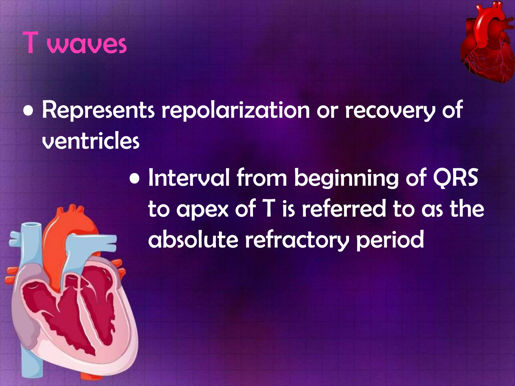 T waves
• Represents repolarization or recovery of
ventricles
• Interval from beginning of QRS
to apex of T is referred to as the
absolute refractory period

 