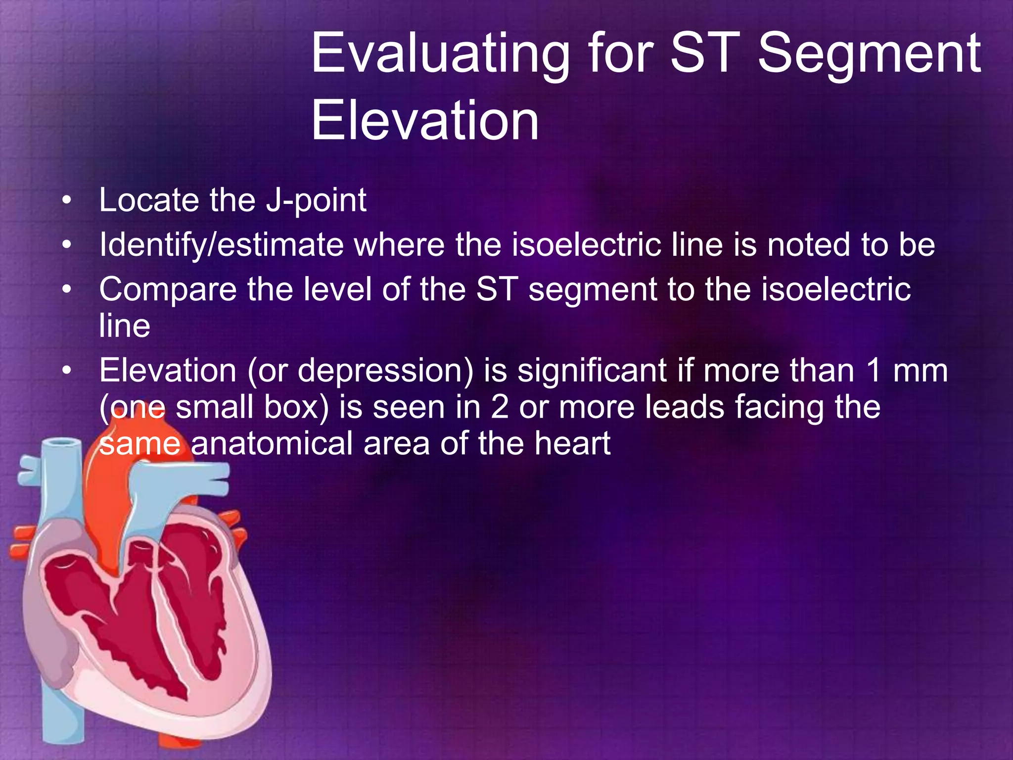 Evaluating for ST Segment
Elevation
• Locate the J-point
• Identify/estimate where the isoelectric line is noted to be
• Compare the level of the ST segment to the isoelectric
line
• Elevation (or depression) is significant if more than 1 mm
(one small box) is seen in 2 or more leads facing the
same anatomical area of the heart

 