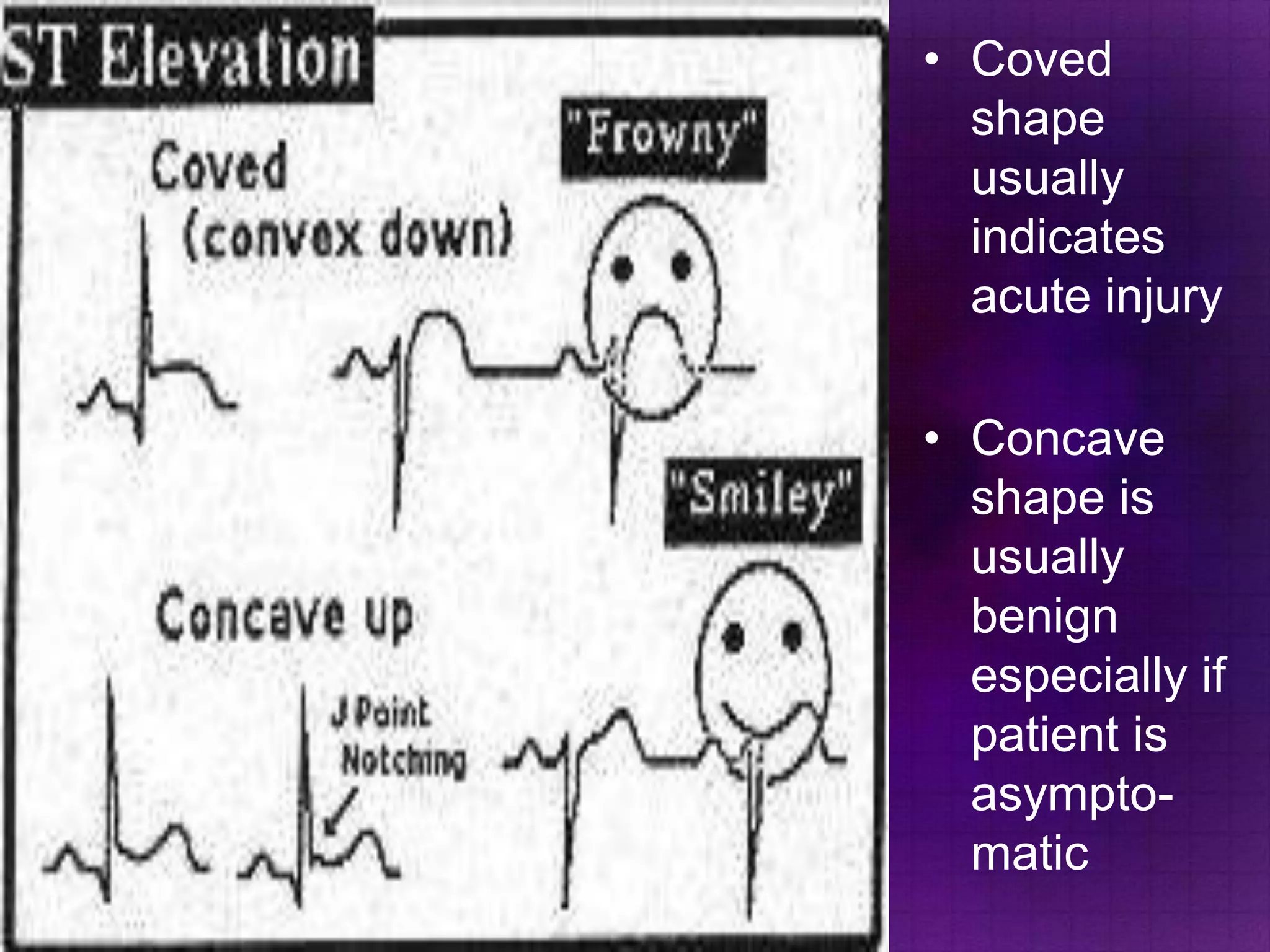 • Coved
shape
usually
indicates
acute injury
• Concave
shape is
usually
benign
especially if
patient is
asymptomatic

 
