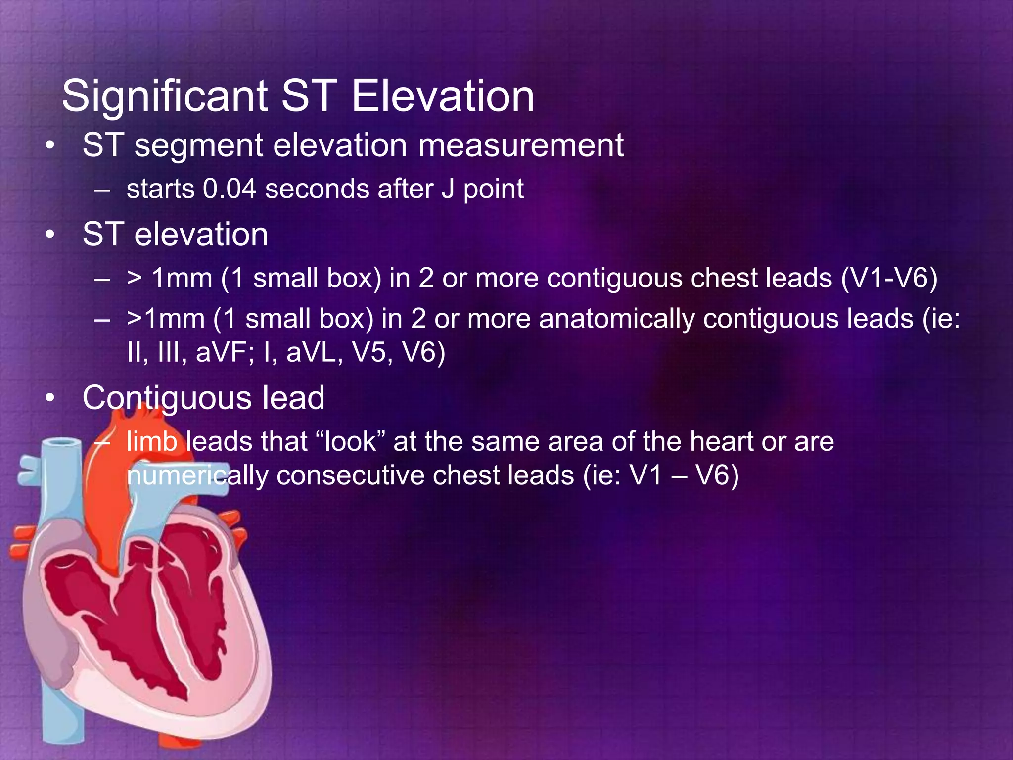 Significant ST Elevation
• ST segment elevation measurement
– starts 0.04 seconds after J point

• ST elevation
– > 1mm (1 small box) in 2 or more contiguous chest leads (V1-V6)
– >1mm (1 small box) in 2 or more anatomically contiguous leads (ie:
II, III, aVF; I, aVL, V5, V6)

• Contiguous lead
– limb leads that “look” at the same area of the heart or are
numerically consecutive chest leads (ie: V1 – V6)

 