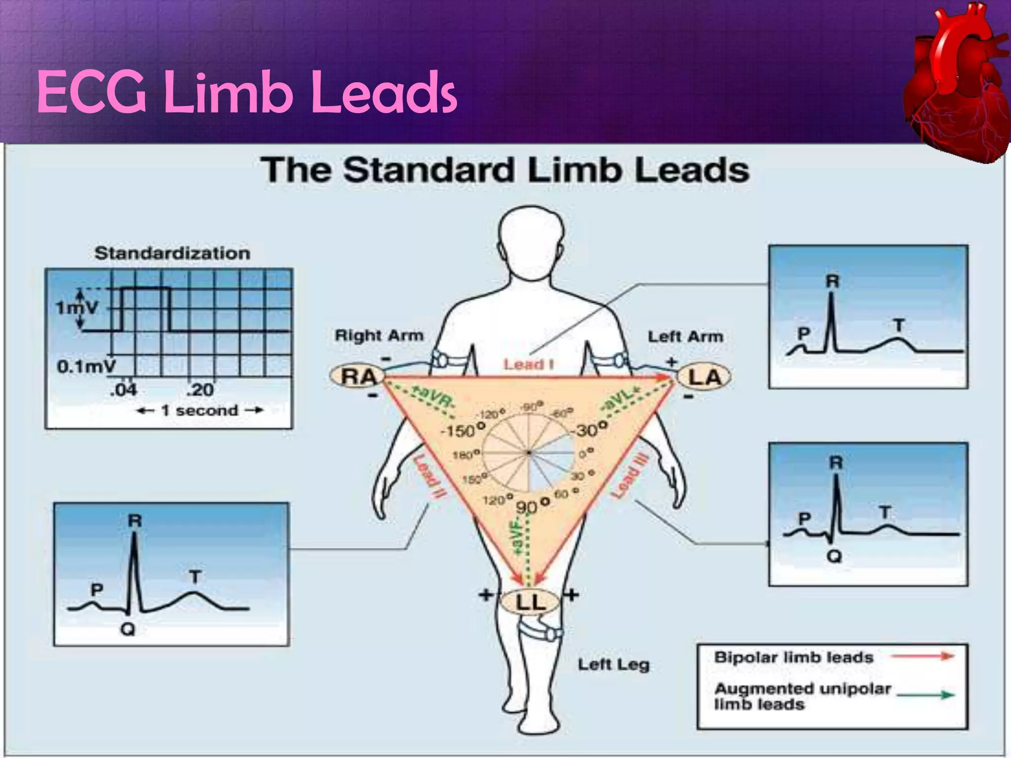 ECG Limb Leads

 