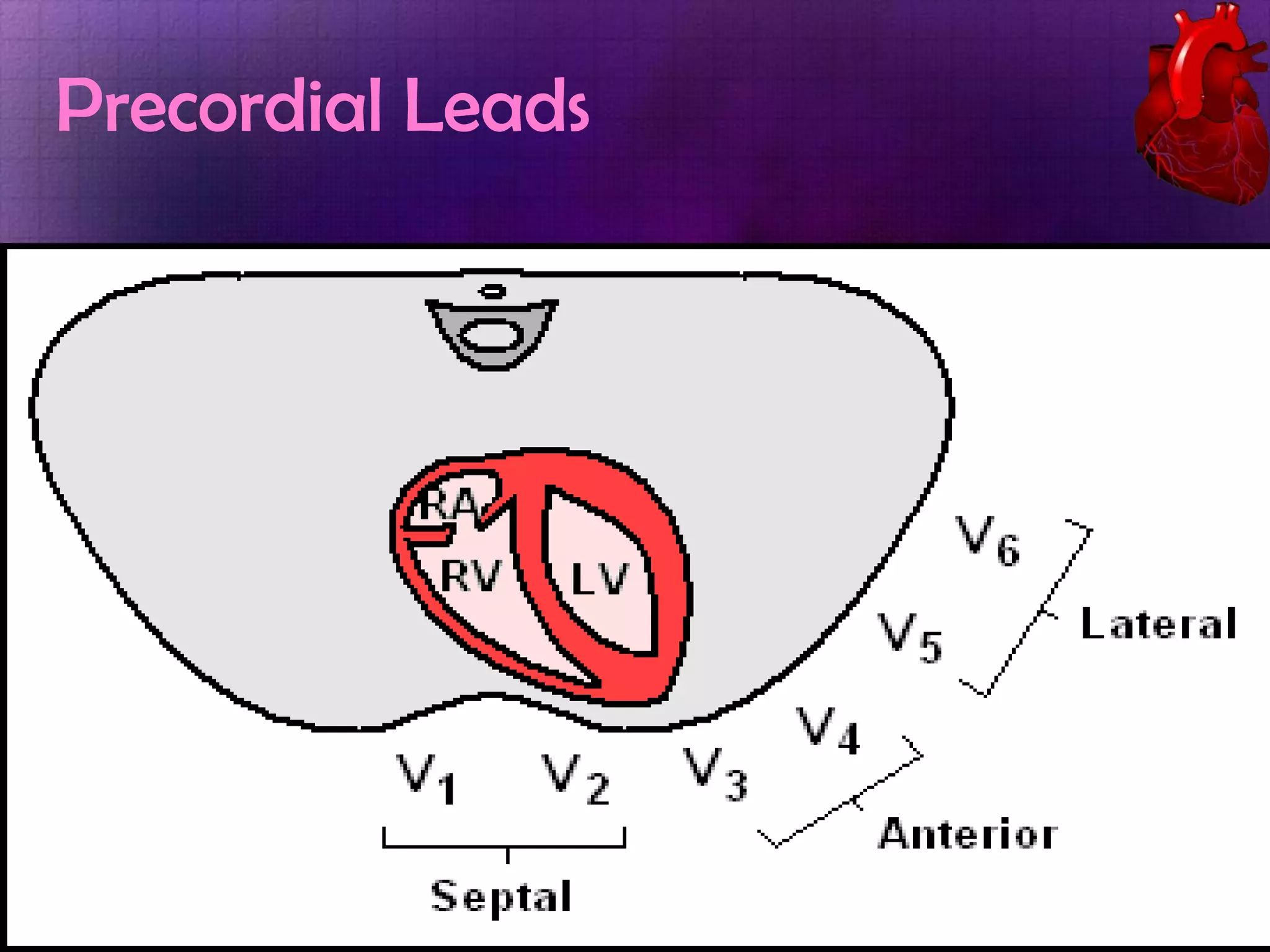 Precordial Leads

 