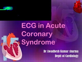 ECG in Acute
Coronary
Syndrome
Dr Awadhesh Kumar sharma
Deptt of Cardiology

 