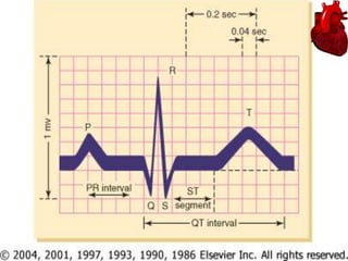 ST segment
• Connects the QRS complex and T wave
• Duration of 0.08-0.12 sec (80-120 msec)

 