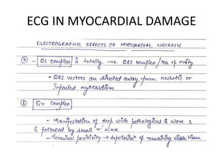ECG IN MYOCARDIAL DAMAGE
 