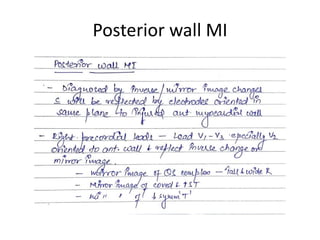 Posterior wall MI
 