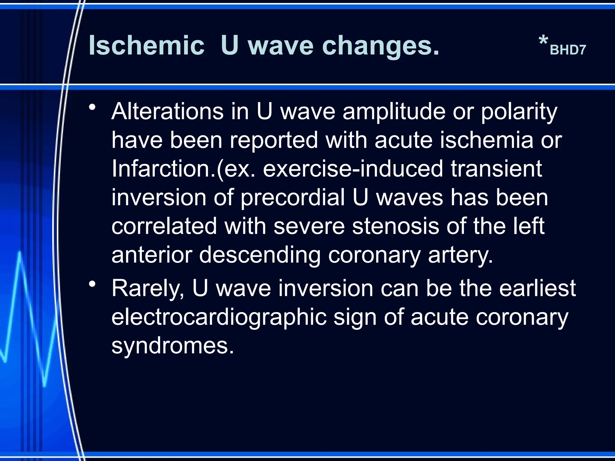 electrocardiography in acute coronary syndrome.pptx
