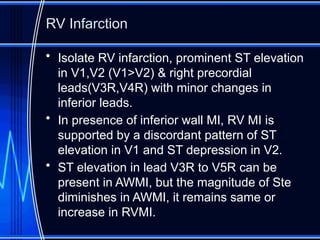 Preload Effected Rv Infarct electrocardiography in acute coronary syndrome.pptx