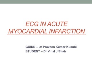 ECG in Acute Myocardial Infarction | PPTX