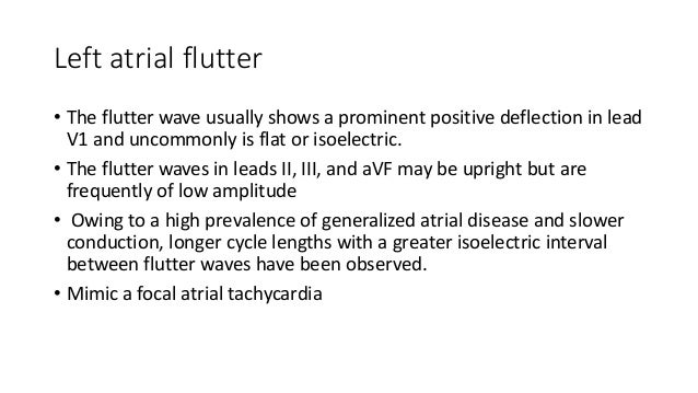 ecg in aflutter