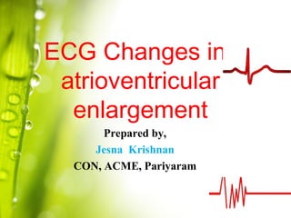 ECG Changes in
atrioventricular
enlargement
Prepared by,
Jesna Krishnan
CON, ACME, Pariyaram
 