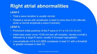 Right atrial abnormalities
LEAD II
• Total p wave duration is usually normal.
• Peaked p waves with amplitudes in lead to more than 0.25 millivolts
(even a normal amplitude p wave if pointed)
LEAD V1
• Prominent initial positivity of the P wave in V1 or V2 (>0.15 mV)
• Initial area under curve >0.06 mm-sec qR complex, namely a small q
followed by a large R wave, usually in tricuspid regurgitation
• Low-amplitude (<0.6 mV) QRS complexes in lead V1 with a threefold
or greater increase in lead V2
Chamber Enlargement & Hypertrophy 17
 