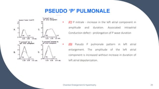 • (C) P mitrale - increase in the left atrial component in
amplitude and duration. Associated intraatrial
Conduction defect - prolongation of P wave duration
Chamber Enlargement & Hypertrophy 25
PSEUDO ‘P’ PULMONALE
• (D) Pseudo P pulmonale pattern in left atrial
enlargement. The amplitude of the left atrial
component is increased without increase in duration of
left atrial depolarization.
 