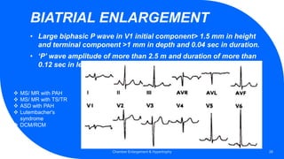 BIATRIAL ENLARGEMENT
• Large biphasic P wave in V1 initial component> 1.5 mm in height
and terminal component >1 mm in depth and 0.04 sec in duration.
• ‘P’ wave amplitude of more than 2.5 m and duration of more than
0.12 sec in lead II.
Chamber Enlargement & Hypertrophy 26
 MS/ MR with PAH
 MS/ MR with TS/TR
 ASD with PAH
 Lutembacher's
syndrome
 DCM/RCM
 