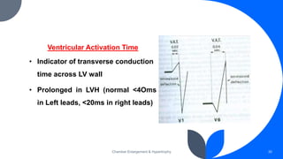 Chamber Enlargement & Hypertrophy 30
Ventricular Activation Time
• Indicator of transverse conduction
time across LV wall
• Prolonged in LVH (normal <4Oms
in Left leads, <20ms in right leads)
 