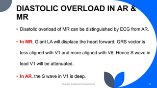 DIASTOLIC OVERLOAD IN AR &
MR
• Diastolic overload of MR can be distinguished by ECG from AR.
• In MR, Giant LA will displace the heart forward, QRS vector is
less aligned with V1 and more aligned with V6. Hence S wave in
lead V1 will be attenuated.
• In AR, the S wave in V1 is deep.
Chamber Enlargement & Hypertrophy 34
 