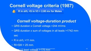 Cornell voltage criteria (1987)
R in aVL +S in V3 > 2.80 mv for Males
Chamber Enlargement & Hypertrophy 36
Cornell voltage-duration product
• QRS duration x Cornell voltage >244 mVms
• QRS duration x sum of voltages in all leads >1742 mm-
sec
• R in aVL >11 mm.
• RI+SIII > 25 mm.
• Total 12 lead voltage >175 mm
 