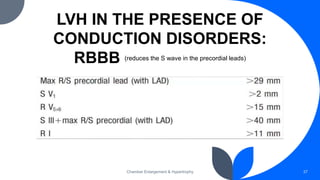 LVH IN THE PRESENCE OF
CONDUCTION DISORDERS:
RBBB (reduces the S wave in the precordial leads)
Chamber Enlargement & Hypertrophy 37
 
