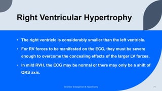 Right Ventricular Hypertrophy
• The right ventricle is considerably smaller than the left ventricle.
• For RV forces to be manifested on the ECG, they must be severe
enough to overcome the concealing effects of the larger LV forces.
• In mild RVH, the ECG may be normal or there may only be a shift of
QRS axis.
Chamber Enlargement & Hypertrophy 41
 